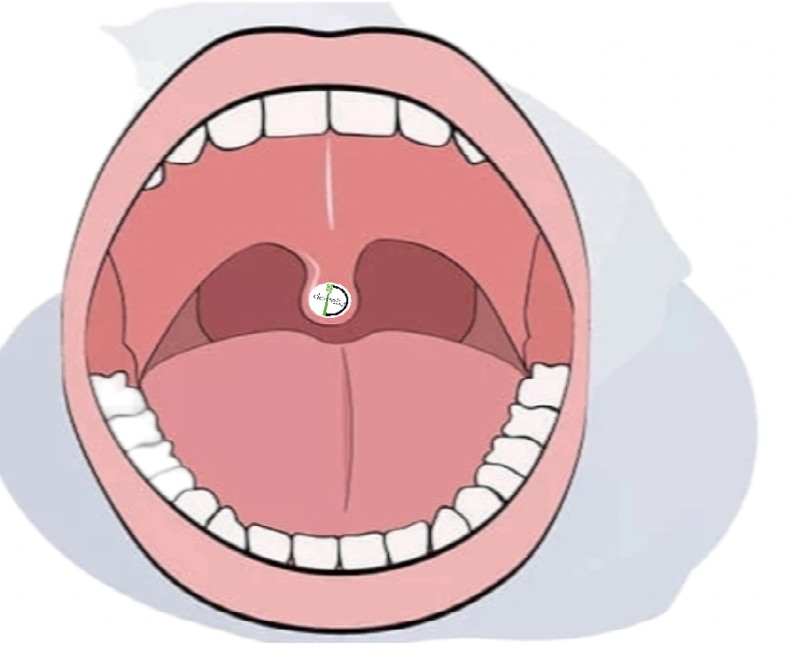 die-mundh-hle-cavum-oris-dentelio